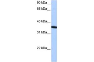 Western Blotting (WB) image for anti-Zinc Finger Protein 192 Pseudogene 1 (ZNF192P1) antibody (ABIN2463407) (ZNF192P1 antibody)