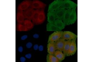ABIN6262446 and ABIN6278479 staining Hela cells(30 min of UV treatment) by IF/ICC.