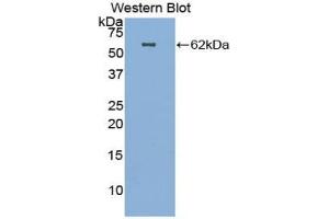 Western blot analysis of the recombinant protein. (HGF antibody  (AA 32-291))