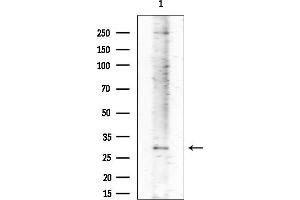 anti-Abhydrolase Domain Containing 11 (ABHD11) (C-Term) antibody