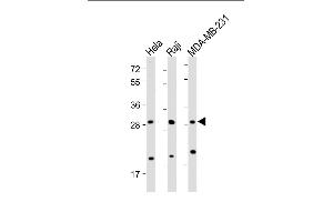 All lanes : Anti-RAB12 Antibody (N-term) at 1:2000 dilution Lane 1: Hela whole cell lysate Lane 2: Raji whole cell lysate Lane 3: MDA-MB-231 whole cell lysate Lysates/proteins at 20 μg per lane. (RAB12 antibody  (N-Term))