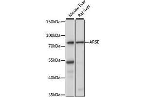 Western blot analysis of extracts of various cell lines, using ARSE antibody (ABIN7265688) at 1:1000 dilution. (Arylsulfatase E antibody  (AA 520-589))