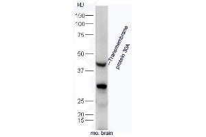 TMEM30A antibody  (AA 251-350)