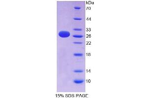 SDS-PAGE (SDS) image for Ephrin A3 (EFNA3) (AA 30-238) protein (His tag) (ABIN4990164) (Ephrin A3 Protein (EFNA3) (AA 30-238) (His tag))