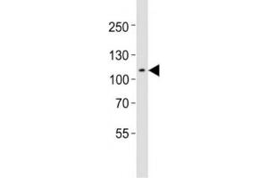 Western blot testing of Mertk antibody at 1:1000 dilution + mouse spleen lysate; Predicted molecular weight: 110~205 kDa depending on glycosylation level (MERTK antibody  (C-Term))
