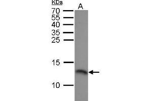 WB Image RPA14 antibody detects RPA14 protein by Western blot analysis. (RPA3 antibody)
