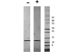 SDS-PAGE of Human Chemerin Recombinant Protein SDS-PAGE of Human Chemerin Recombinant Protein. (Chemerin Protein)