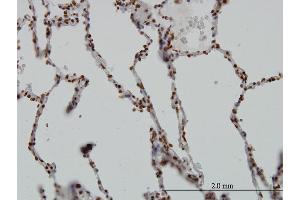 Immunoperoxidase of monoclonal antibody to SGK on formalin-fixed paraffin-embedded human lung. (SGK1 antibody  (AA 1-90))