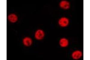 ABIN6277875 staining 293T by IF/ICC. (TGIF1 antibody  (C-Term))