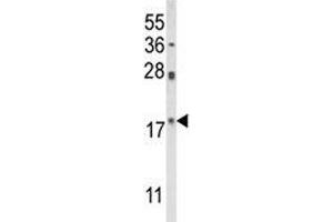 Western blot analysis of PIN1 antibody and HL-60 lysate (PIN1 antibody  (AA 30-56))