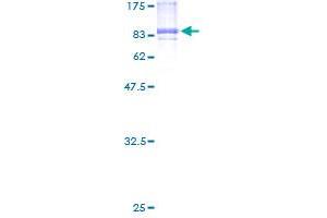 CAP2 Protein (AA 1-477) (GST tag)