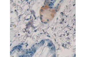 Used in DAB staining on fromalin fixed paraffin- embedded Kidney tissue (Keratin 2 antibody  (AA 200-508))