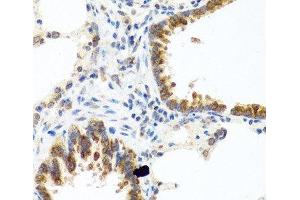 Immunohistochemistry of paraffin-embedded Rat lung using C8orf4 Polyclonal Antibody at dilution of 1:100 (40x lens). (C8orf4 antibody)