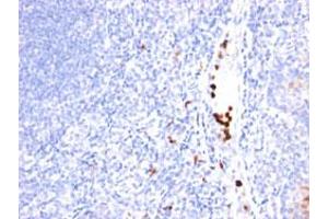 Immunohistochemical staining (Formalin-fixed paraffin-embedded sections) of human tonsil with MYADM monoclonal antibody, clone MYADM/971 . (MYADM antibody)