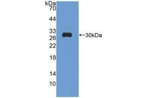 Detection of Recombinant GR, Rat using Polyclonal Antibody to Glutathione Reductase (GR) (Glutathione Reductase antibody  (AA 7-246))