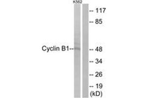 Western blot analysis of extracts from K562 cells, treated with serum 10 % 15', using Cyclin B1 (Ab-126) Antibody. (Cyclin B1 antibody  (AA 91-140))