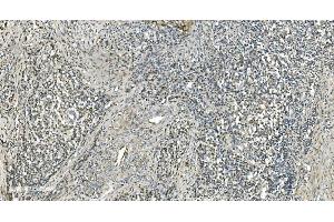 IHC analysis of LSM7 using anti-LSM7 antibody (ABIN7598937). (LSM7 antibody  (AA 1-103))