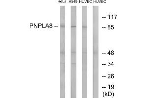 Western blot analysis of extracts from HeLa cells, A549 cells and HUVEC cells, using PNPLA8 antibody. (PNPLA8 antibody  (C-Term))