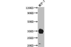 Western Blot Positive WB detected in: MCF-7 whole cell lysate All lanes: IGFBP2 antibody at 1:1000 Secondary Goat polyclonal to rabbit IgG at 1/50000 dilution Predicted band size: 35 kDa Observed band size: 35 kDa (Recombinant IGFBP2 antibody)
