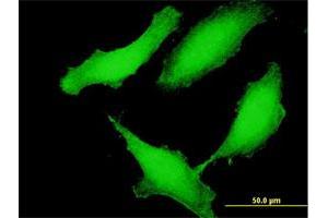 Immunofluorescence of purified MaxPab antibody to CCDC115 on HeLa cell. (CCDC115 antibody  (AA 1-180))