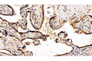 Detection of LIFR in Human Placenta Tissue using Polyclonal Antibody to Leukemia Inhibitory Factor Receptor (LIFR) (LIFR antibody  (AA 522-691))