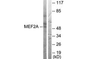 Western blot analysis of extracts from HeLa cells, treated with PMA 125ng/ml 30', using MEF2A (Ab-408) Antibody. (MEF2A antibody  (AA 374-423))
