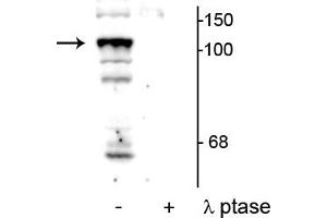 Western blot of mouse testicular lysate showing specific immunolabeling of the ~104 kDa PTPH1 phosphorylated at Ser459 in the first lane (-).