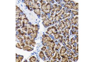 Immunohistochemistry (IHC) image for anti-Ribosomal Protein S3 (RPS3) (AA 1-243) antibody (ABIN3023343)