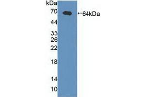 Detection of Recombinant gABRa2, Human using Polyclonal Antibody to Gamma-Aminobutyric Acid A Receptor Alpha 2 (gABRa2) (GABRA2 antibody  (AA 42-250))