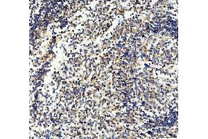 IHC analysis of CD33 using anti-CD33 antibody (ABIN4886523).