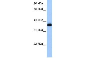 WB Suggested Anti-ERI2 Antibody Titration: 0. (ERI2 antibody  (Middle Region))