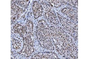 IHC analysis of Lamin A+C/LMNA using anti-Lamin A+C/LMNA antibody (ABIN7601843).