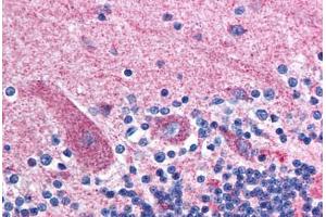 Brain, cerebellum (GABRD antibody  (N-Term))
