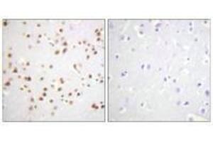 Immunohistochemistry analysis of paraffin-embedded human brain tissue using Catenin-δ1 (Ab-228) antibody. (CTNND1 antibody  (Tyr228))