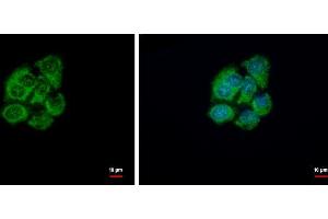 ICC/IF Image GSTZ1 antibody [N1C3] detects GSTZ1 protein at cytoplasm by immunofluorescent analysis. (GSTZ1 antibody)