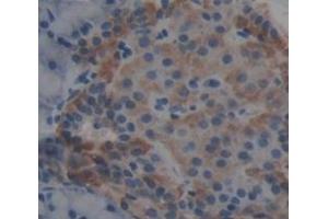 Figure. (CPB1 antibody  (AA 120-415))