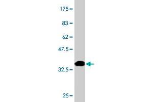 Western Blotting (WB) image for anti-SP110 Nuclear Body Protein (SP110) (AA 271-380) antibody (ABIN561432)