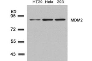 Image no. 2 for anti-Mdm2, p53 E3 Ubiquitin Protein Ligase Homolog (Mouse) (MDM2) (Ser166) antibody (ABIN319418) (MDM2 antibody  (Ser166))