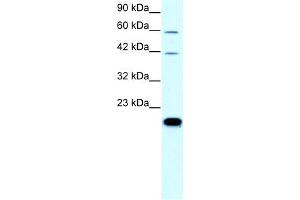 WB Suggested Anti-CLDN23 Antibody Titration:  0.