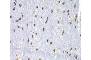 Immunohistochemistry of paraffin-embedded Mouse brain using Lyn Polyclonal Antibody at dilution of 1:100 (40x lens). (LYN antibody)