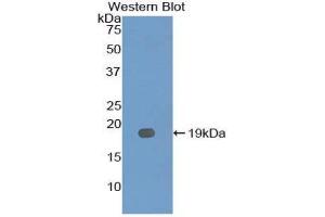 Western Blotting (WB) image for anti-Interleukin 12 Receptor, beta 2 (IL12RB2) (AA 285-441) antibody (ABIN3207280) (IL12RB2 antibody  (AA 285-441))