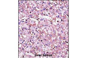 IGF1 Antibody (C-term) (ABIN658020 and ABIN2837861) immunohistochemistry analysis in formalin fixed and paraffin embedded human liver tissue followed by peroxidase conjugation of the secondary antibody and DAB staining. (IGF1 antibody  (C-Term))