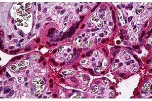 Human Placenta: Formalin-Fixed, Paraffin-Embedded (FFPE) (STAT5B antibody  (AA 678-788))