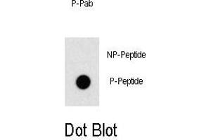 Dot blot analysis of anti-Phospho-OSR1-p Antibody Antibody (ABIN389959 and ABIN2839760) on nitrocellulose membrane. (OSR1 antibody  (pThr310))