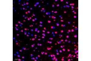 Immunofluorescence of paraffin embedded mouse brain using TYW1B (ABIN7076025) at dilution of 1: 650 (400x lens) (TYW1B antibody)