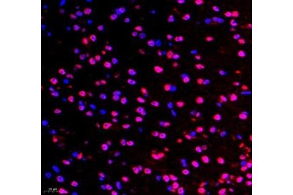 TYW1B antibody