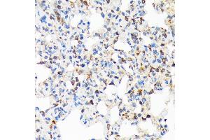 Immunohistochemistry of paraffin-embedded rat lung using TIRAP Rabbit mAb (ABIN7270842) at dilution of 1:100 (40x lens). (TIRAP antibody)