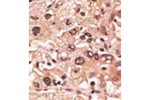 Image no. 2 for anti-Melanoma Antigen Family F, 1 (MAGEF1) (C-Term) antibody (ABIN358660) (MAGEF1 antibody  (C-Term))