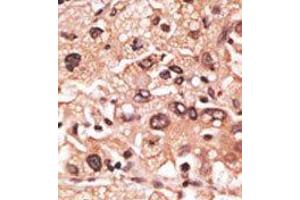 Image no. 2 for anti-Melanoma Antigen Family F, 1 (MAGEF1) (C-Term) antibody (ABIN358660)