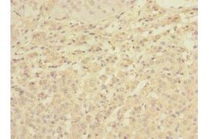 Immunohistochemistry of paraffin-embedded human adrenal gland tissue using ABIN7174780 at dilution of 1:100